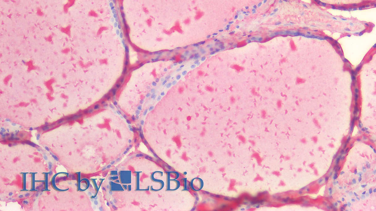Polyclonal Antibody to Thyroglobulin (TG)
