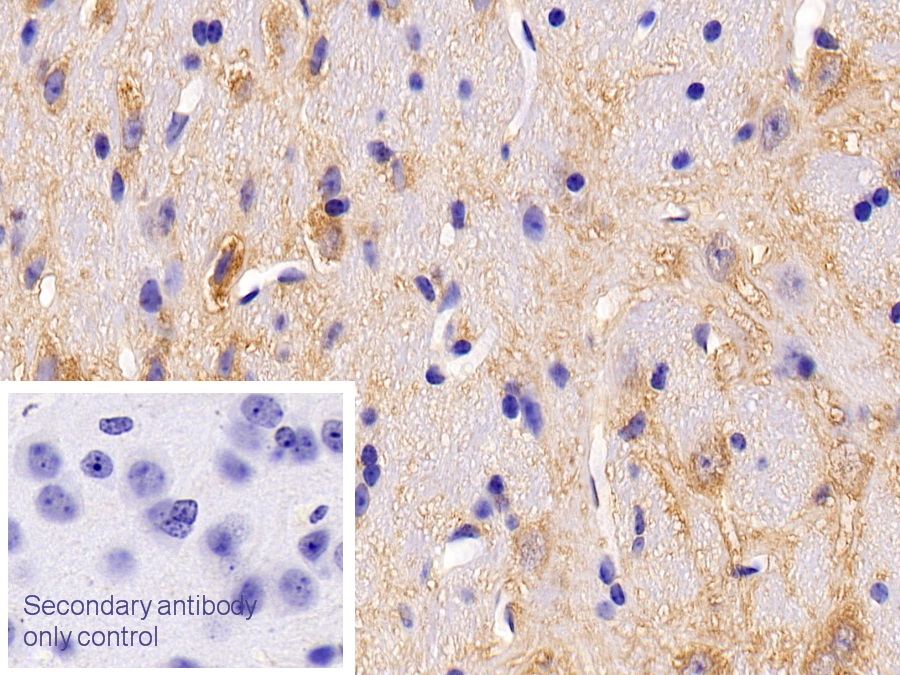 Polyclonal Antibody to Protein Kinase Inhibitor Beta (PKIb)