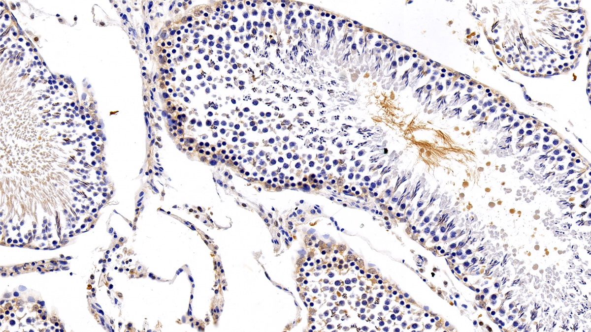 Polyclonal Antibody to Protein Kinase Inhibitor Beta (PKIb)