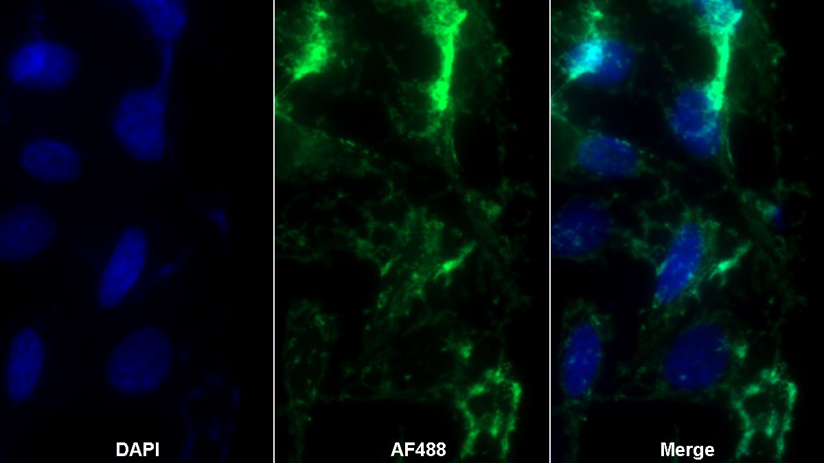 Polyclonal Antibody to Acyl Carrier Protein, Mitochondrial (ACP)