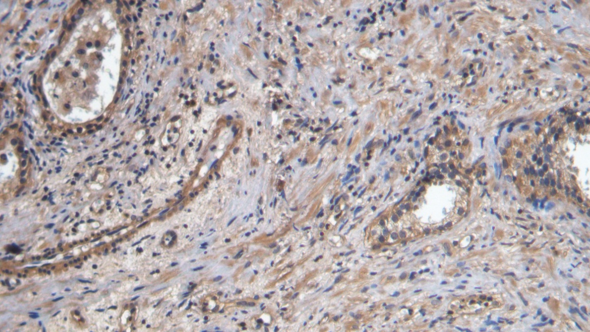 Polyclonal Antibody to Platelet/Endothelial Cell Adhesion Molecule (PECAM1)