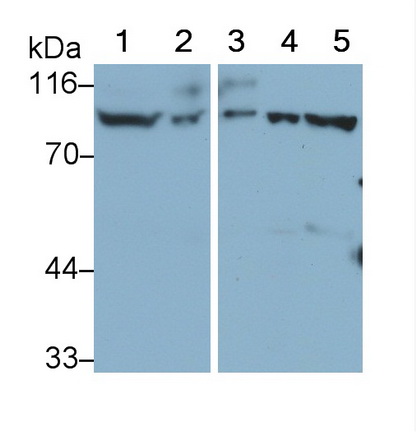 Polyclonal Antibody to Platelet/Endothelial Cell Adhesion Molecule (PECAM1)