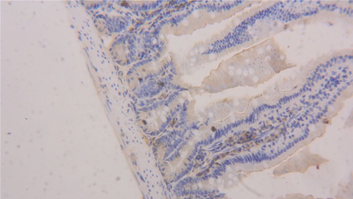 Polyclonal Antibody to Platelet/Endothelial Cell Adhesion Molecule (PECAM1)