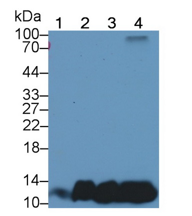 Polyclonal Antibody to Chemokine (C-X-C motif) ligand 7 ( CXCL7)