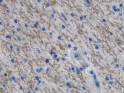 Polyclonal Antibody to Interferon Gamma Induced Protein 10kDa (IP10)