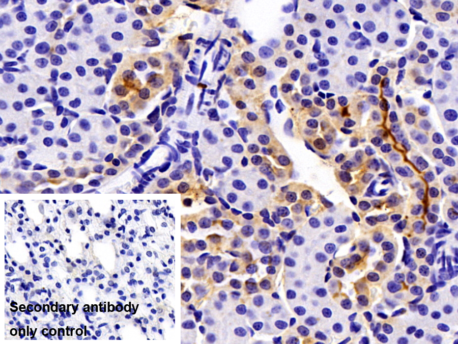 Polyclonal Antibody to Gelsolin (GSN)