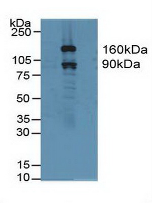 Polyclonal Antibody to Gelsolin (GSN)