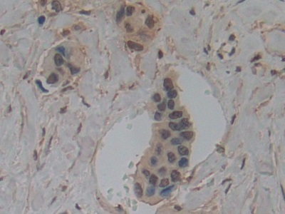 Polyclonal Antibody to Gelsolin (GSN)