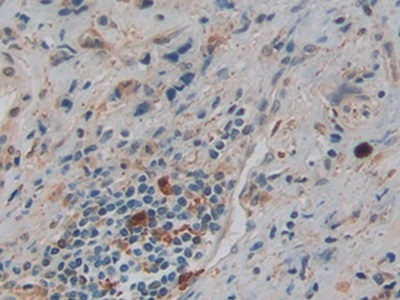 Polyclonal Antibody to Gelsolin (GSN)