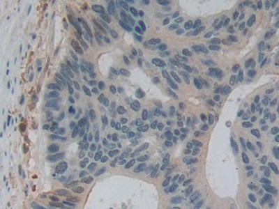 Polyclonal Antibody to Gelsolin (GSN)