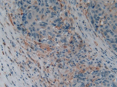 Polyclonal Antibody to Gelsolin (GSN)