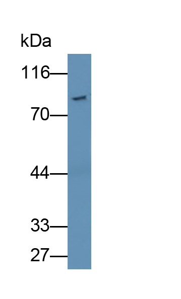 Polyclonal Antibody to Gelsolin (GSN)