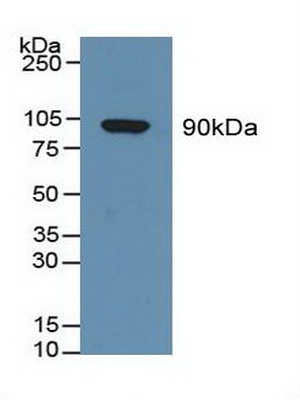 Polyclonal Antibody to Gelsolin (GSN)