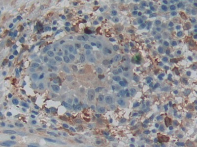 Polyclonal Antibody to Gelsolin (GSN)