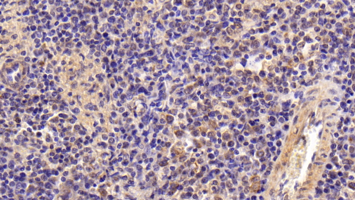 Polyclonal Antibody to Gelsolin (GSN)