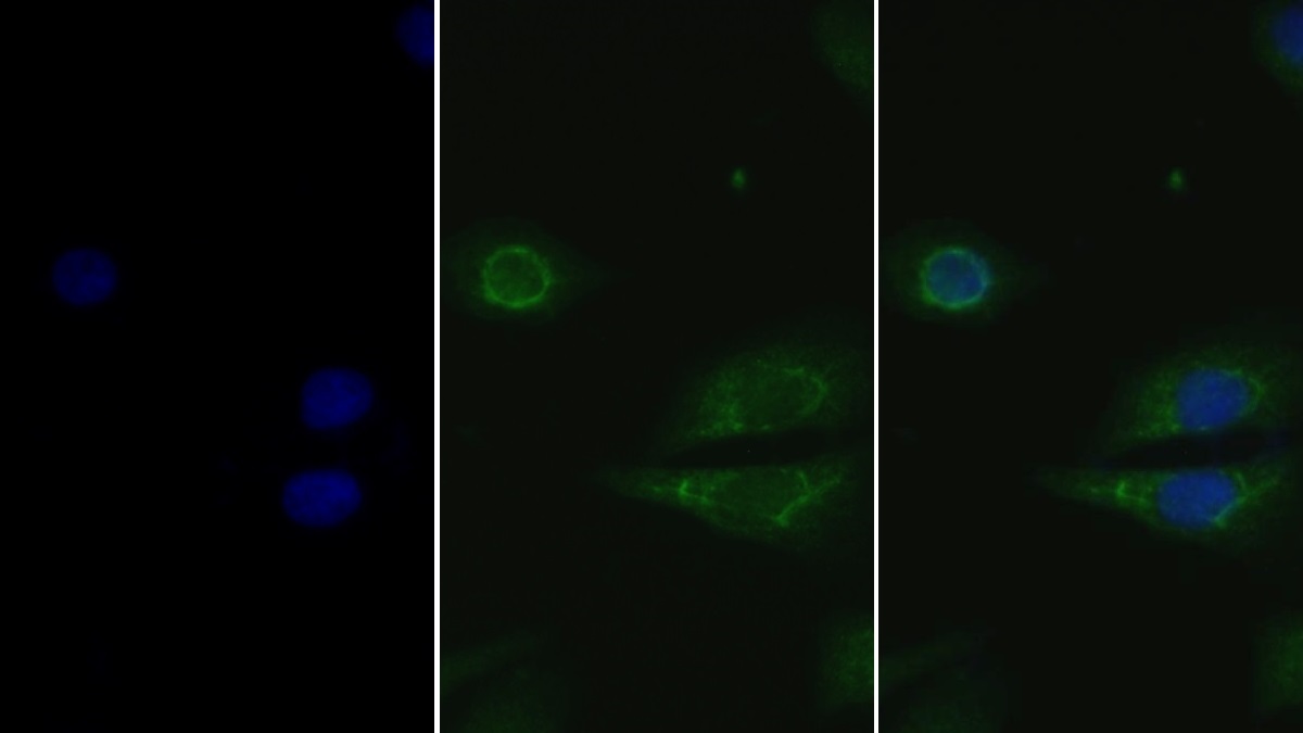 Polyclonal Antibody to Gelsolin (GSN)