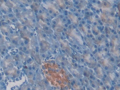 Polyclonal Antibody to Gelsolin (GSN)