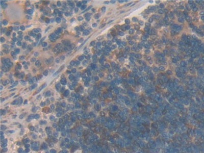 Polyclonal Antibody to Gelsolin (GSN)