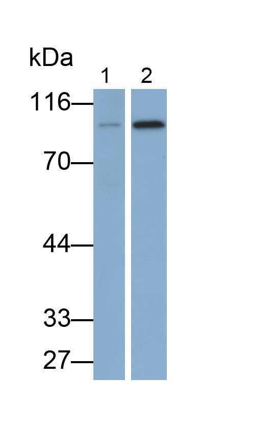 Polyclonal Antibody to Gelsolin (GSN)