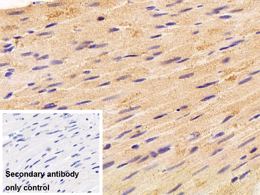 Polyclonal Antibody to Gelsolin (GSN)