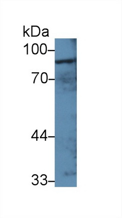 Polyclonal Antibody to Gelsolin (GSN)