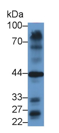 Polyclonal Antibody to GATA Binding Protein 4 (GATA4)