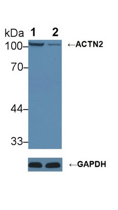 Polyclonal Antibody to Actinin Alpha 2 (ACTN2)