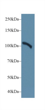 Polyclonal Antibody to Actinin Alpha 2 (ACTN2)