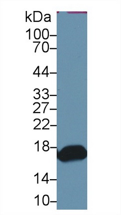 Polyclonal Antibody to Retinol Binding Protein 2, Cellular (RBP2)