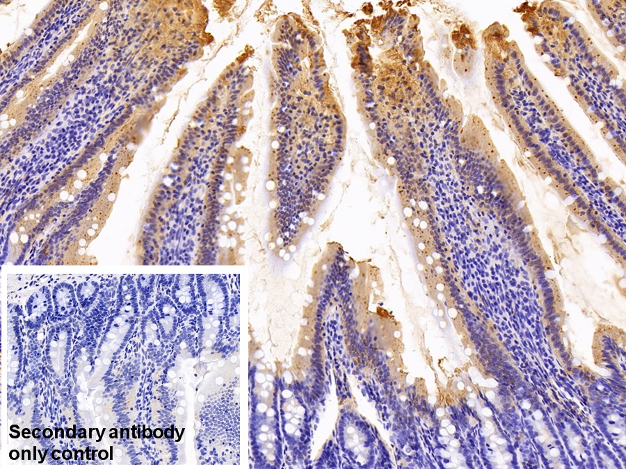 Polyclonal Antibody to Retinol Binding Protein 2, Cellular (RBP2)