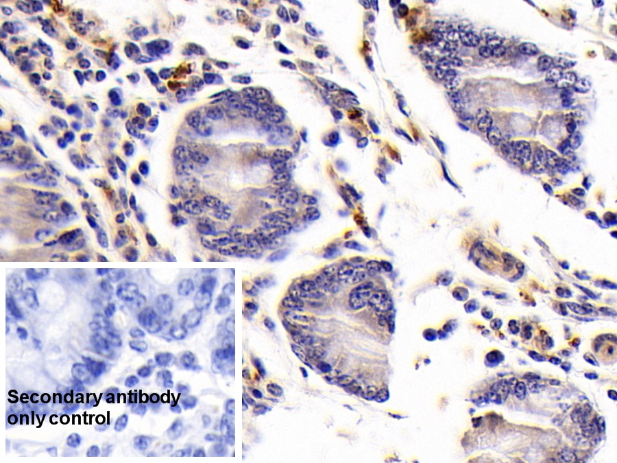 Polyclonal Antibody to Vasoactive Intestinal Peptide (VIP)