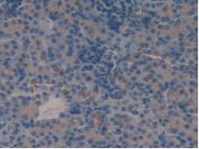 Polyclonal Antibody to Vasoactive Intestinal Peptide (VIP)