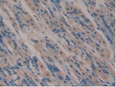 Polyclonal Antibody to Vasoactive Intestinal Peptide (VIP)