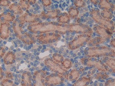 Polyclonal Antibody to Vasoactive Intestinal Peptide (VIP)