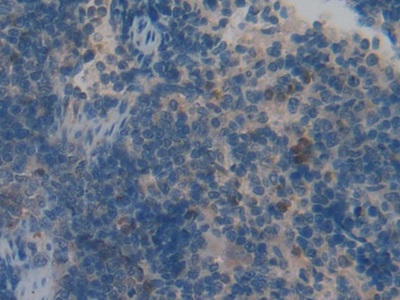 Polyclonal Antibody to Vasoactive Intestinal Peptide (VIP)