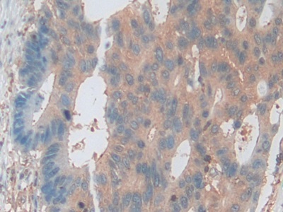 Polyclonal Antibody to Protein Kinase B Gamma (PKBg)