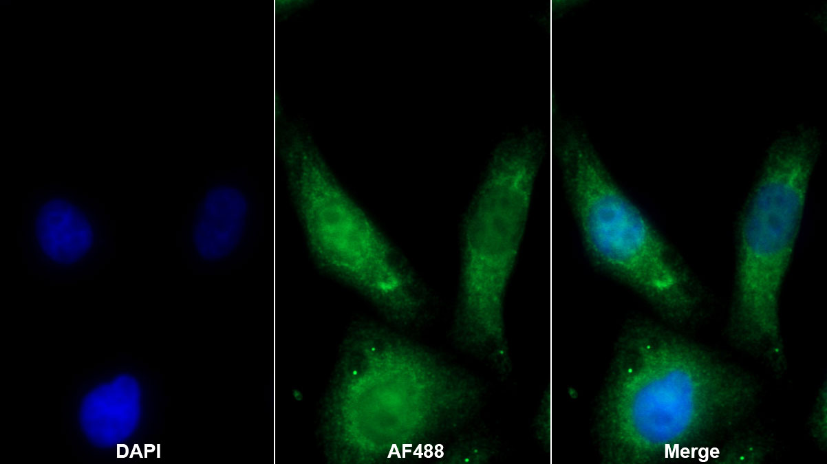 Polyclonal Antibody to Lipoprotein lipase (LPL)