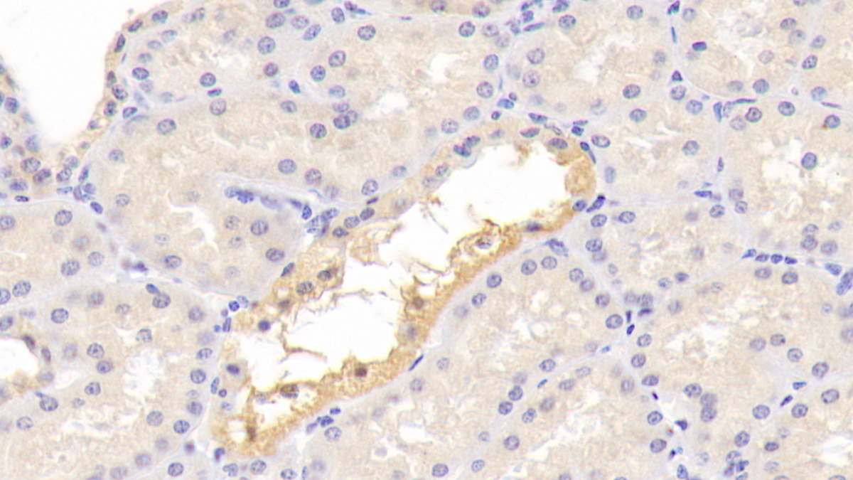 Polyclonal Antibody to Complement Component 3a (C3a)