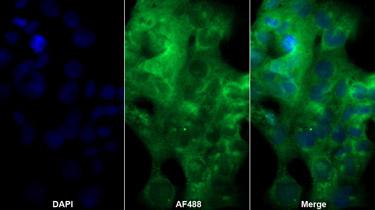 Polyclonal Antibody to Complement Component 3a (C3a)