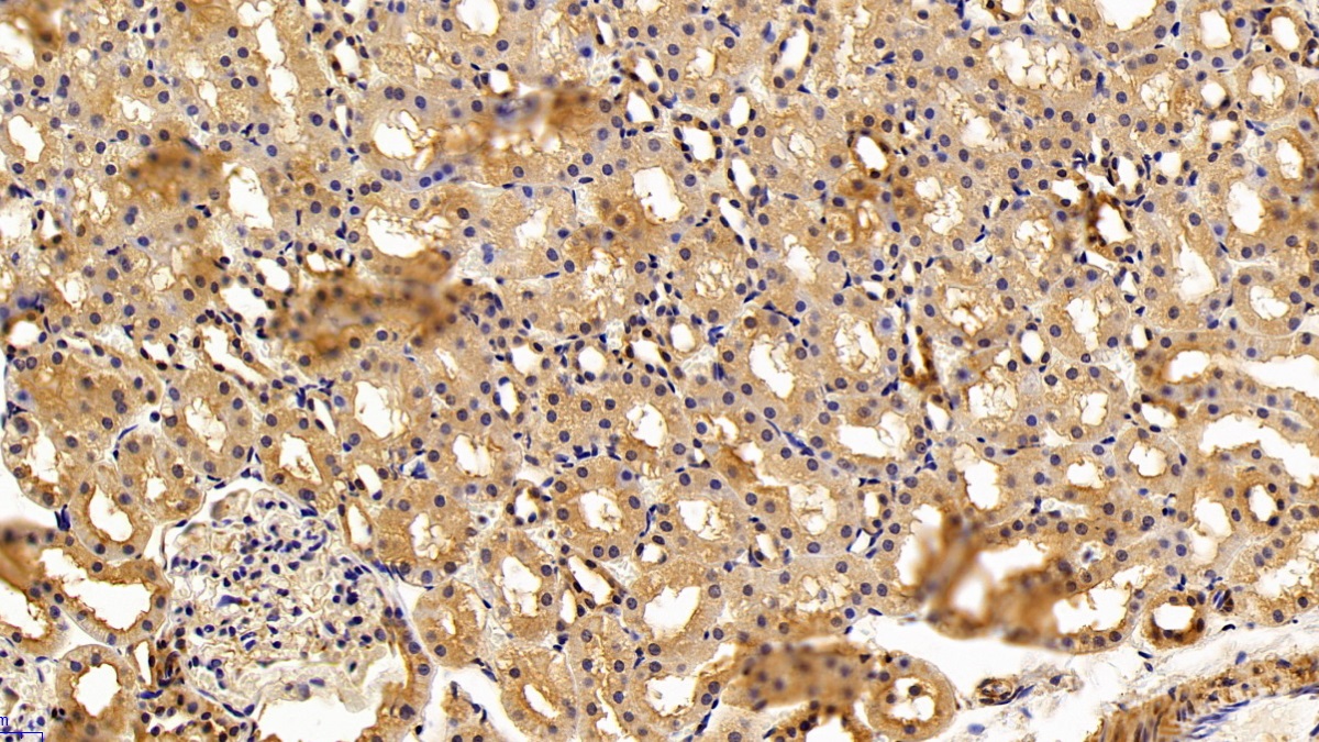 Polyclonal Antibody to Complement Component 3a (C3a)