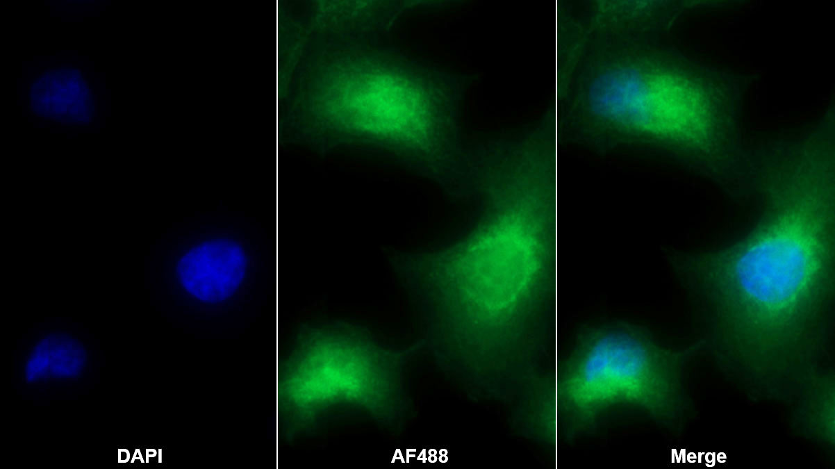 Polyclonal Antibody to Complement Component 5a (C5a)