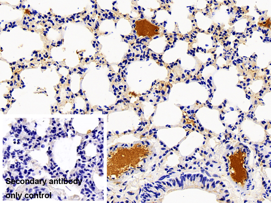 Polyclonal Antibody to Complement Component 5a (C5a)