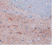 Polyclonal Antibody to Substance P (SP)