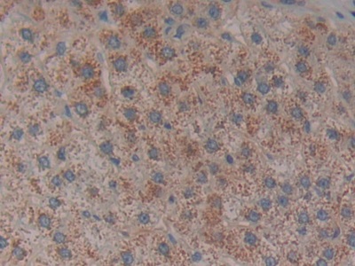 Polyclonal Antibody to Tissue Factor Pathway Inhibitor (TFPI)