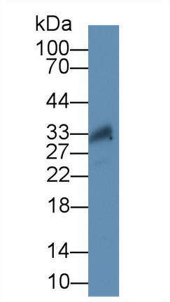 Polyclonal Antibody to Tissue Factor Pathway Inhibitor (TFPI)