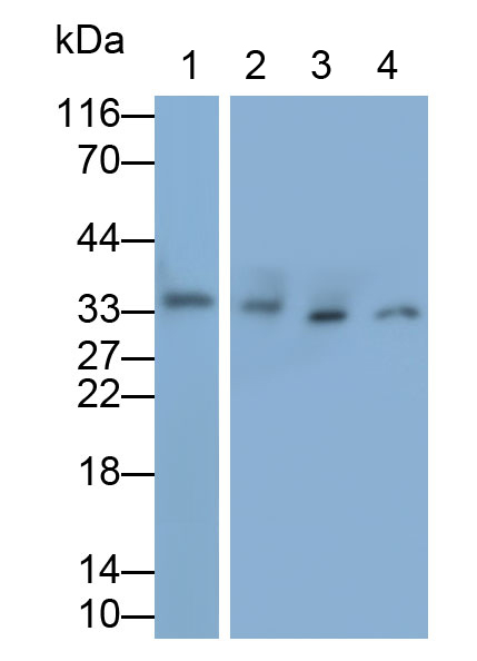 Polyclonal Antibody to Tissue Factor Pathway Inhibitor (TFPI)