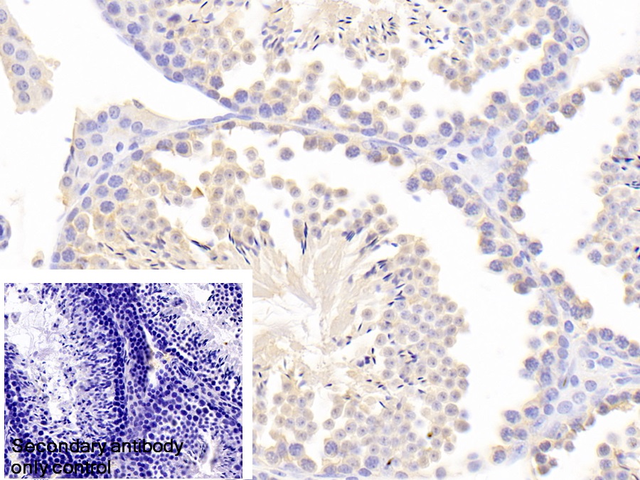 Polyclonal Antibody to Inhibin Alpha (INHa)