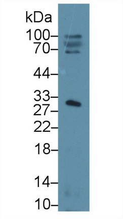 Polyclonal Antibody to Sex Hormone Binding Globulin (SHBG)