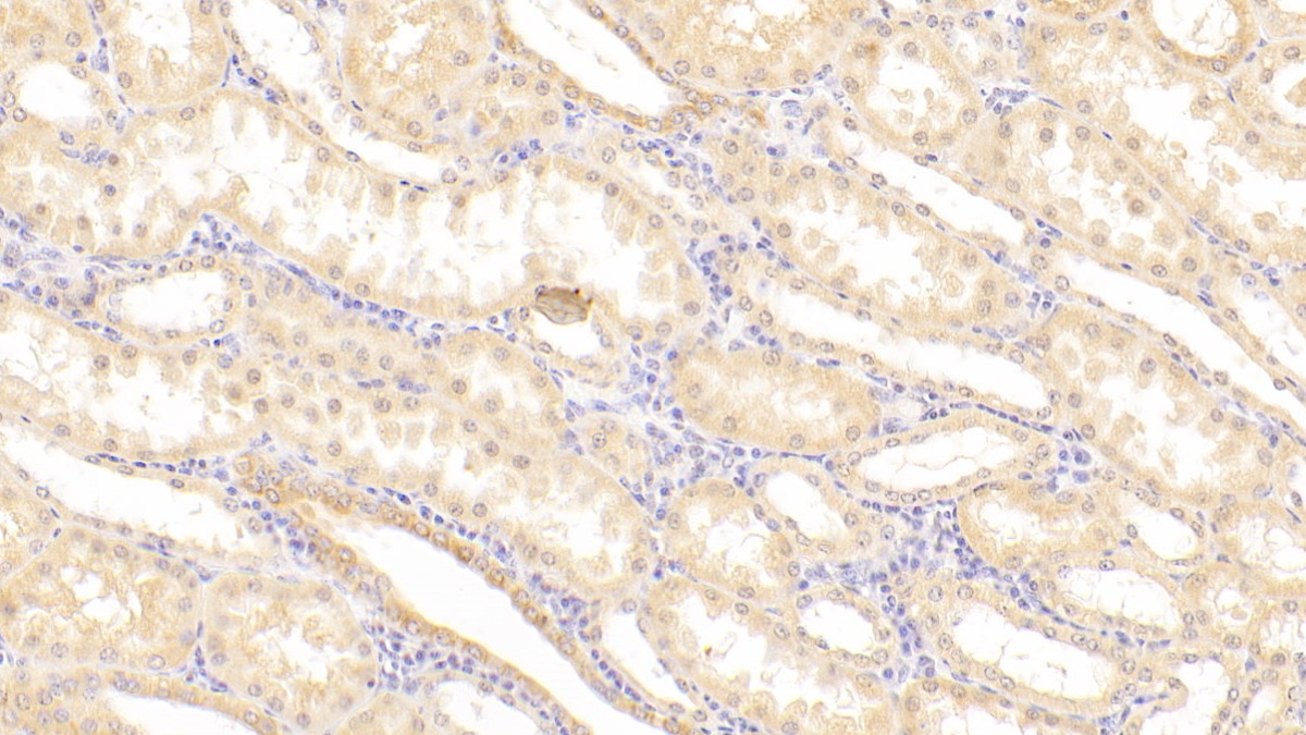 Polyclonal Antibody to Sex Hormone Binding Globulin (SHBG)