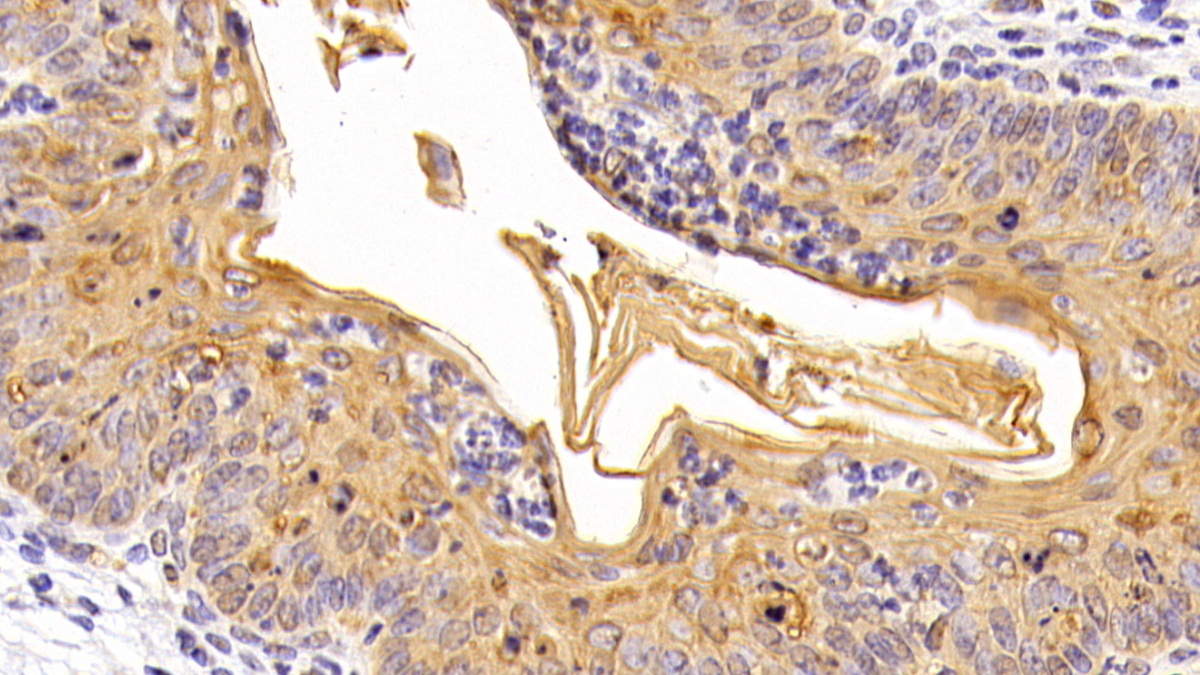 Polyclonal Antibody to Sex Hormone Binding Globulin (SHBG)